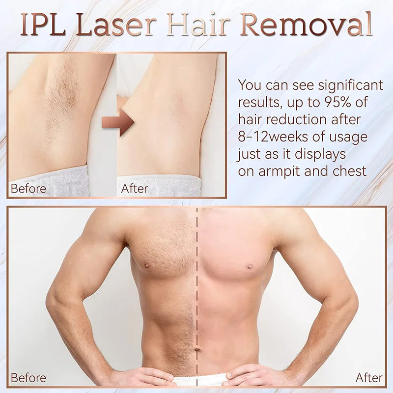 900,000 Flashes IPL Hair Removal System – Painless Permanent Epilator for Women