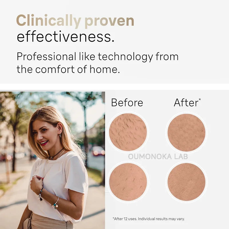 Flashes 3-in-1 IPL Laser Hair Removal – Painless Home Device for Women