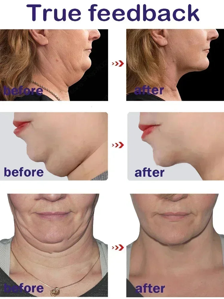 V-Shape Face Slimming Cream – Lifting, Double Chin, Cheek Slimming, Firming & Anti-Wrinkle