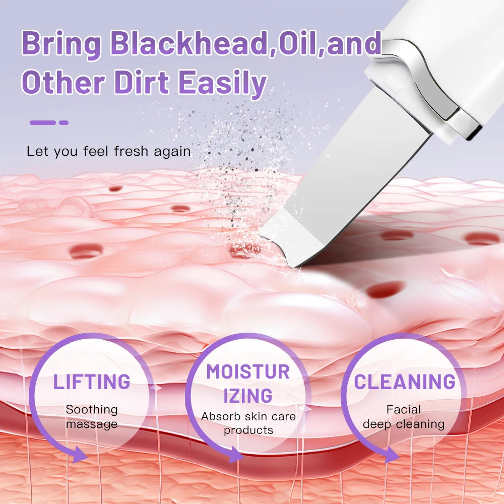 Ultrasonic Skin Scrubber – Electric Face Spatula, Peeling, Blackhead Removal & Facial Lifting