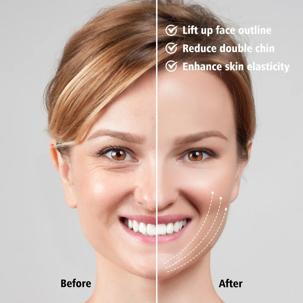 EMS Face Lifting Massager – Anti-Wrinkle, Firming, V-Face, Microcurrent, Double Chin Care