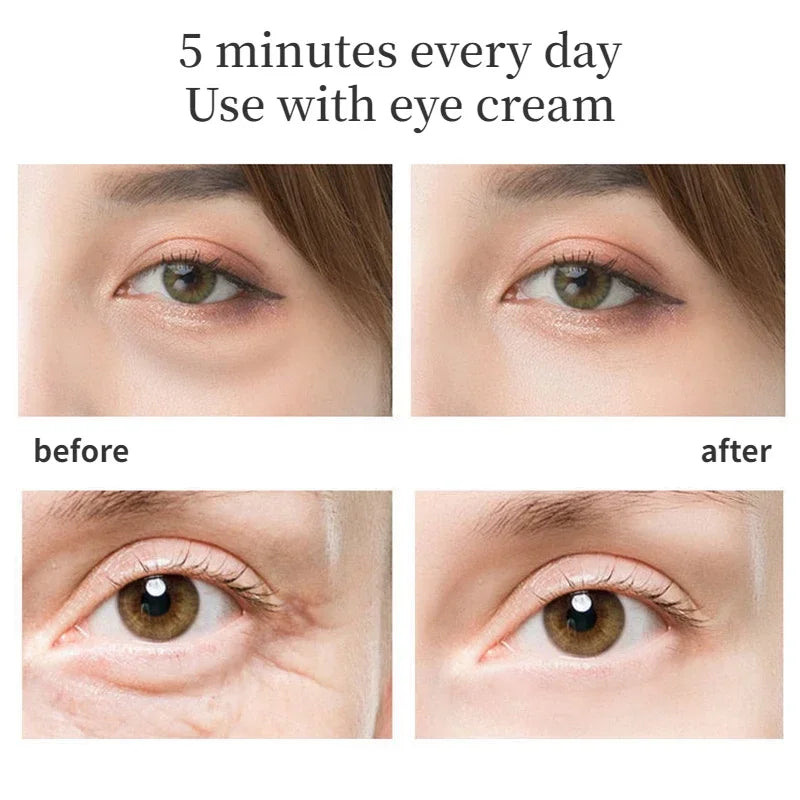EMS Eye Beauty Device – Microcurrent, Light Therapy, Eye Lifting, Anti-Wrinkle, Dark Circle Removal