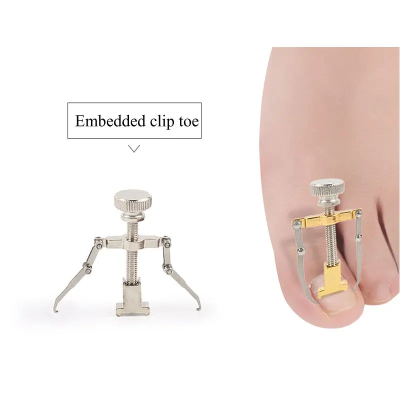 Tcare Ingrown Toenail Corrector – Pedicure Tool, Straightening Clip & Brace for Toe Nail Care