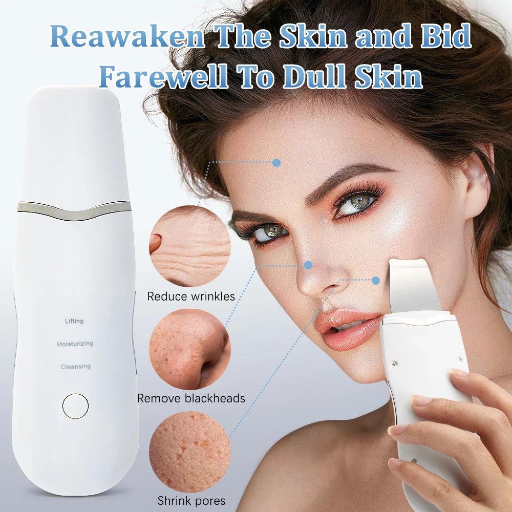 Ultrasonic Skin Scrubber – Electric Face Spatula, Peeling, Blackhead Removal & Facial Lifting