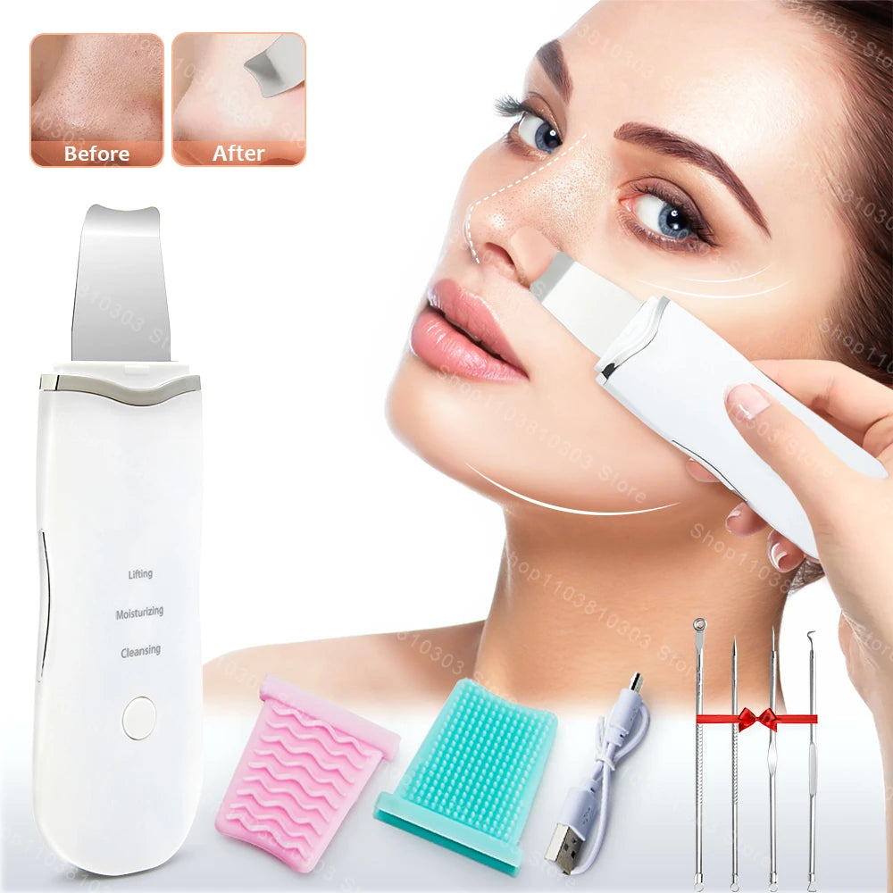 Ultrasonic Skin Scrubber – Electric Face Spatula, Peeling, Blackhead Removal & Facial Lifting