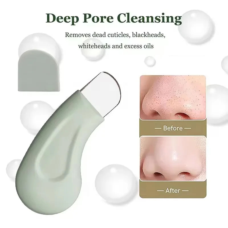 Blackhead & Whitehead Removal Tool – Nose & Face, Pore Cleaner for Women