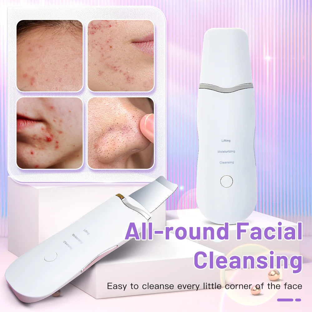 Ultrasonic Skin Scrubber – Electric Face Spatula, Peeling, Blackhead Removal & Facial Lifting
